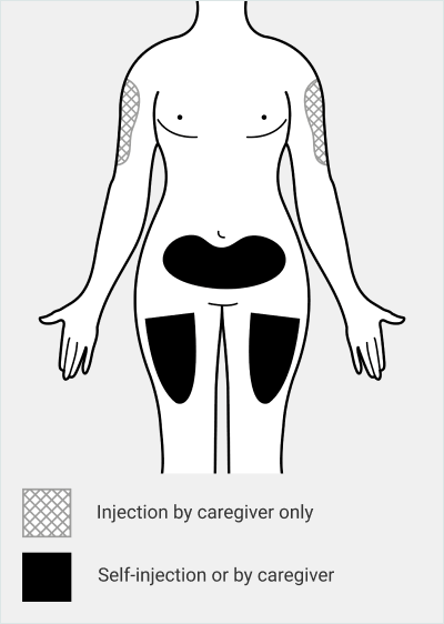 Injection site image